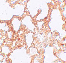2 - ZMYM1 Antibody ASC11267