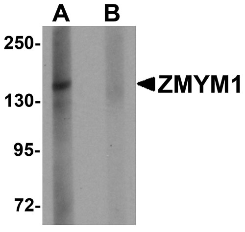 1 - ZMYM1 Antibody ASC11267