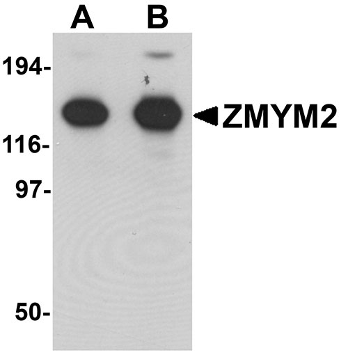 ZMYM2 Antibody - WB, IF, ICC, E - Buy Now!