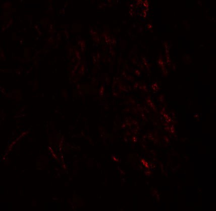 3 - ZMYM3 Antibody ASC11269