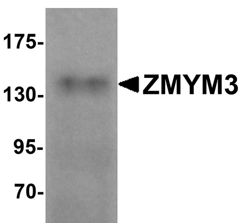 1 - ZMYM3 Antibody ASC11269
