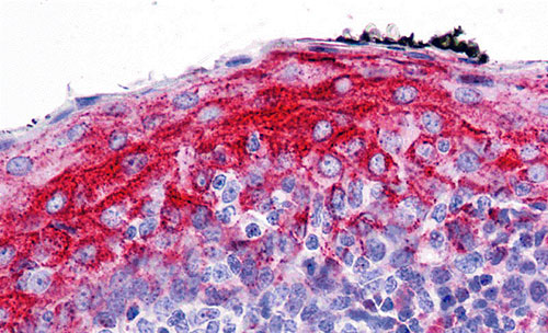 2 - ZMYM4 Antibody ASC11270