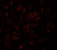 3 - PION Antibody ASC11271