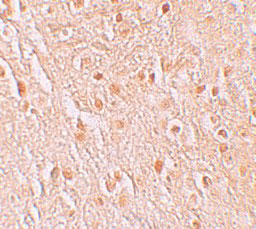 2 - PION Antibody ASC11271