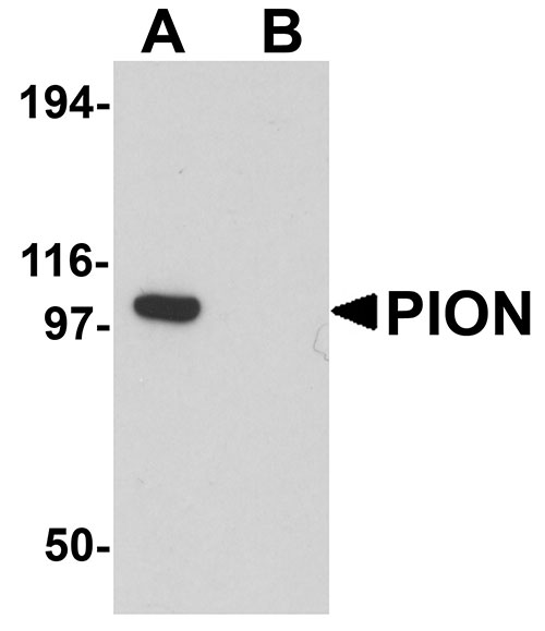 1 - PION Antibody ASC11271