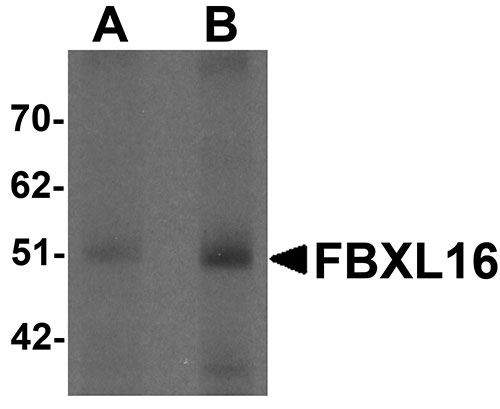 1 - FBXL16 Antibody ASC11273
