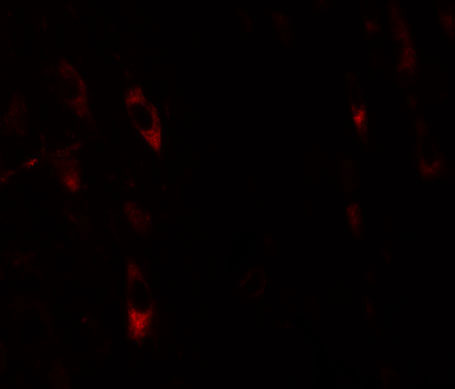 3 - LRRTM1 Antibody ASC11274