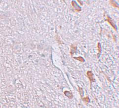 2 - LRRTM1 Antibody ASC11274