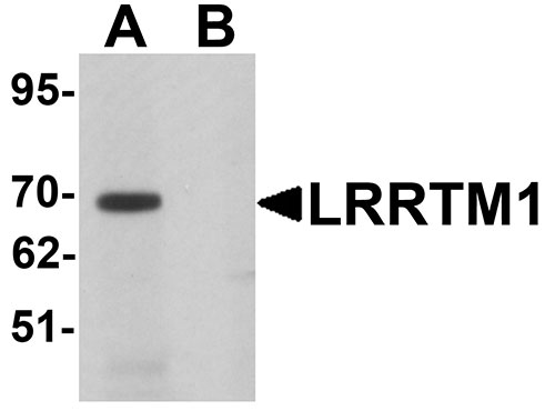 1 - LRRTM1 Antibody ASC11274