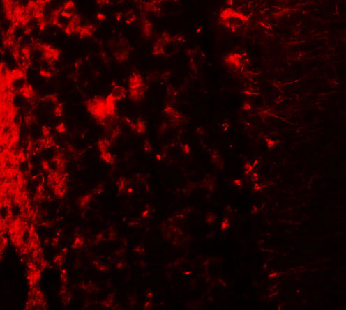 3 - LRRTM2 Antibody ASC11275
