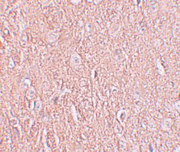2 - LRRTM2 Antibody ASC11275