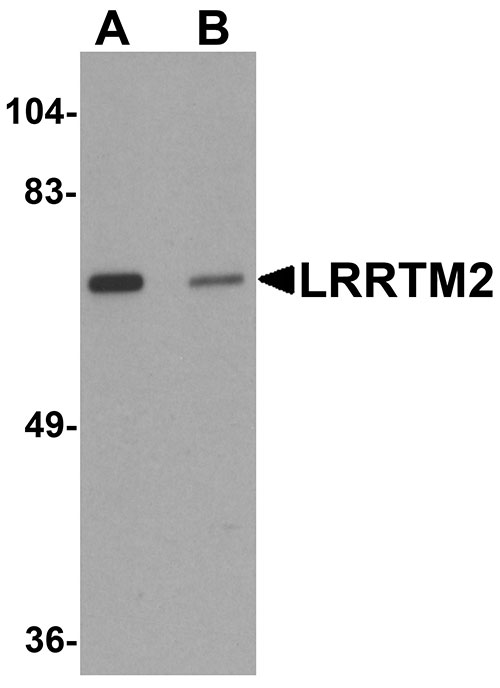 1 - LRRTM2 Antibody ASC11275