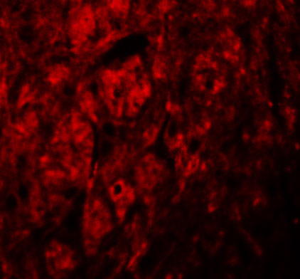 3 - LRRTM3 Antibody ASC11276