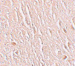 2 - LRRTM3 Antibody ASC11276