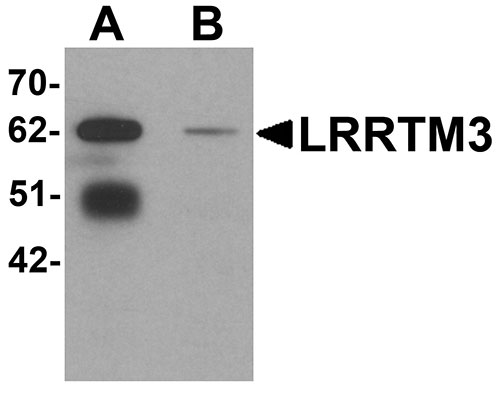 1 - LRRTM3 Antibody ASC11276