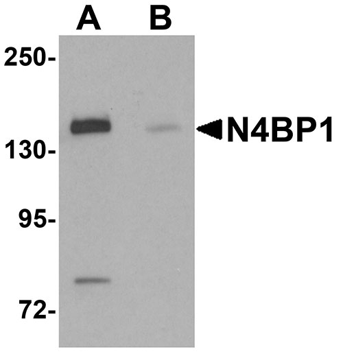 1 - N4BP1 Antibody ASC11278