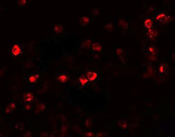 3 - OGFOD1 Antibody ASC11279