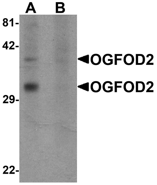 1 - OGFOD2 Antibody ASC11280