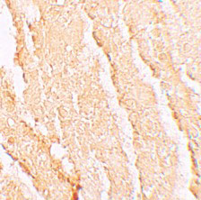 2 - VPS39 Antibody ASC11282