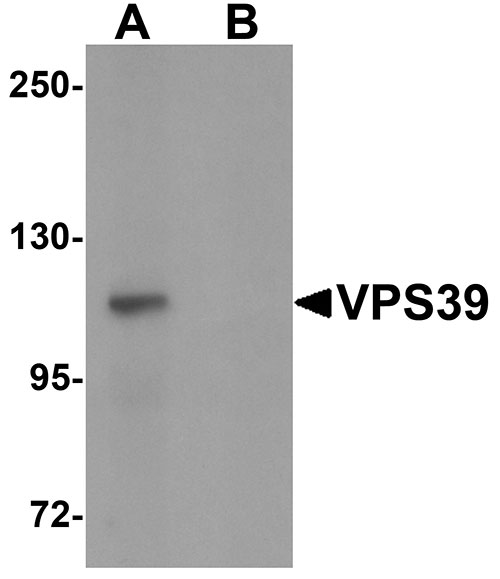 1 - VPS39 Antibody ASC11282