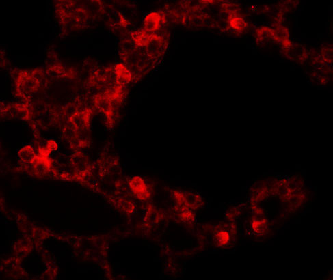 3 - RBM35B Antibody ASC11284
