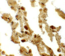 2 - RBM35B Antibody ASC11284