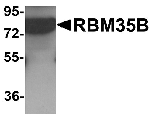 1 - RBM35B Antibody ASC11284