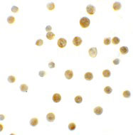 8 - Bcl9L Antibody ASC11289