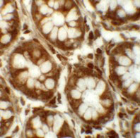 2 - LRRFIP2 Antibody ASC11293