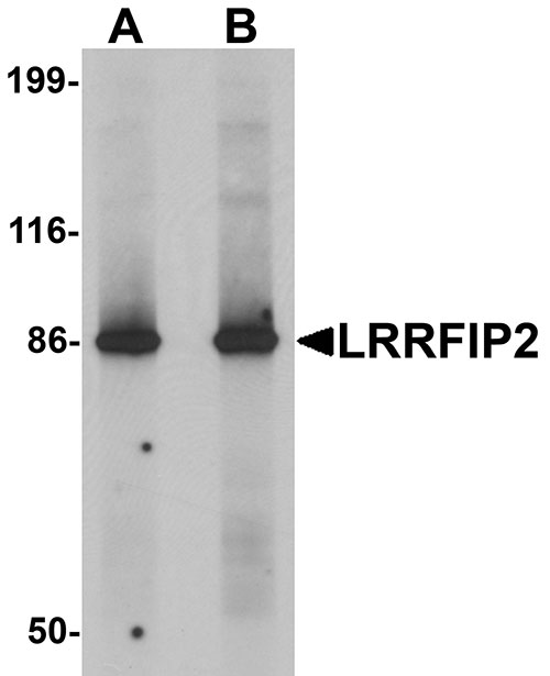 1 - LRRFIP2 Antibody ASC11293