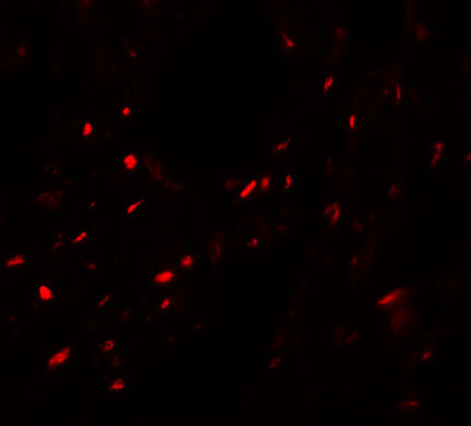 3 - MYOZAP Antibody ASC11294