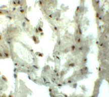 2 - MYOZAP Antibody ASC11294