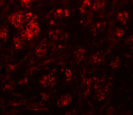 3 - RABEX5 Antibody ASC11295
