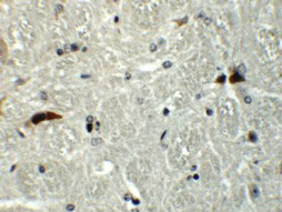 2 - RABEX5 Antibody ASC11295