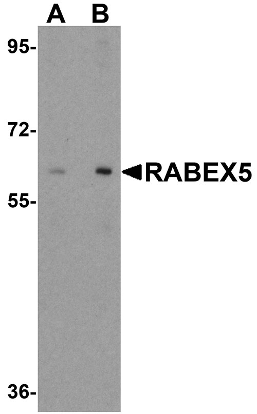 1 - RABEX5 Antibody ASC11295