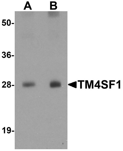 1 - TM4SF1 Antibody ASC11297