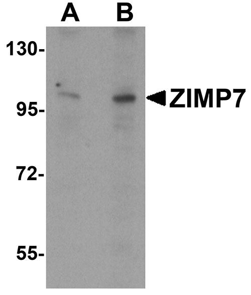 1 - ZIMP7 Antibody ASC11300