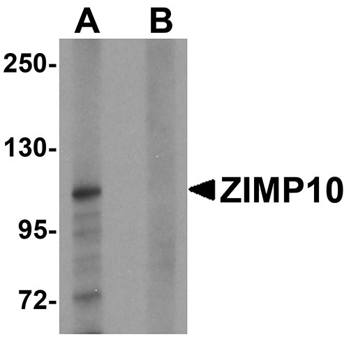 1 - ZIMP10 Antibody ASC11301