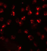 3 - ATP2C2 Antibody ASC11315