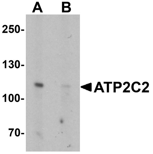 1 - ATP2C2 Antibody ASC11315