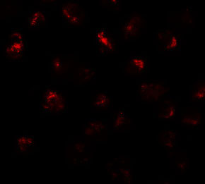 3 - PRR5L Antibody ASC11317