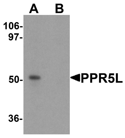 1 - PRR5L Antibody ASC11317