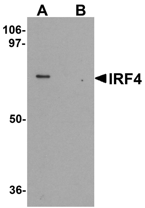 1 - IRF4 Antibody ASC11324
