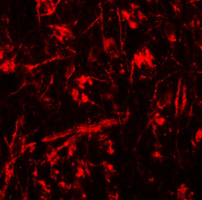 3 - ORMDL1 Antibody ASC11327
