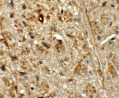 2 - ORMDL1 Antibody ASC11327