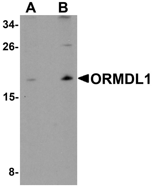 1 - ORMDL1 Antibody ASC11327