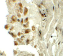 2 - TYW1 Antibody ASC11333