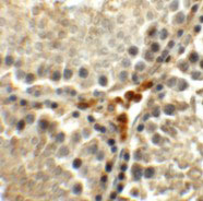 2 - MEIG1 Antibody ASC11337