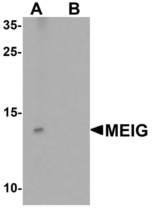 1 - MEIG1 Antibody ASC11337