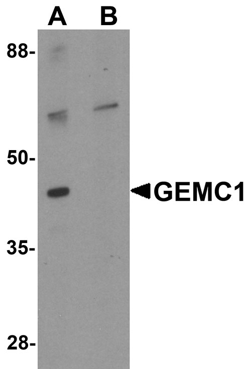 1 - GEMC1 Antibody ASC11339